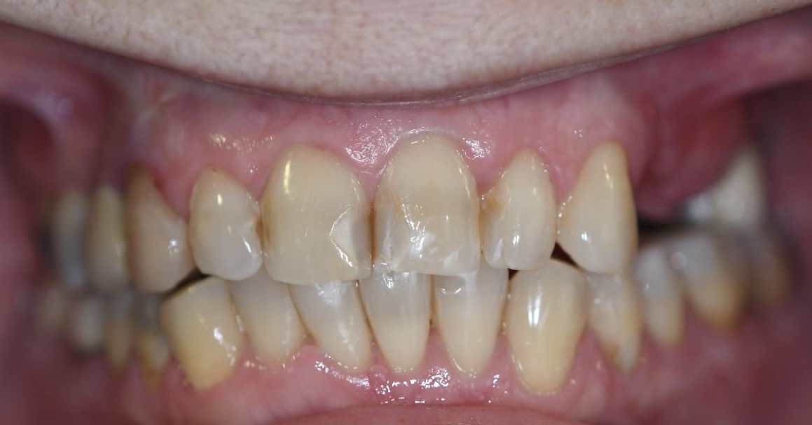 Case before