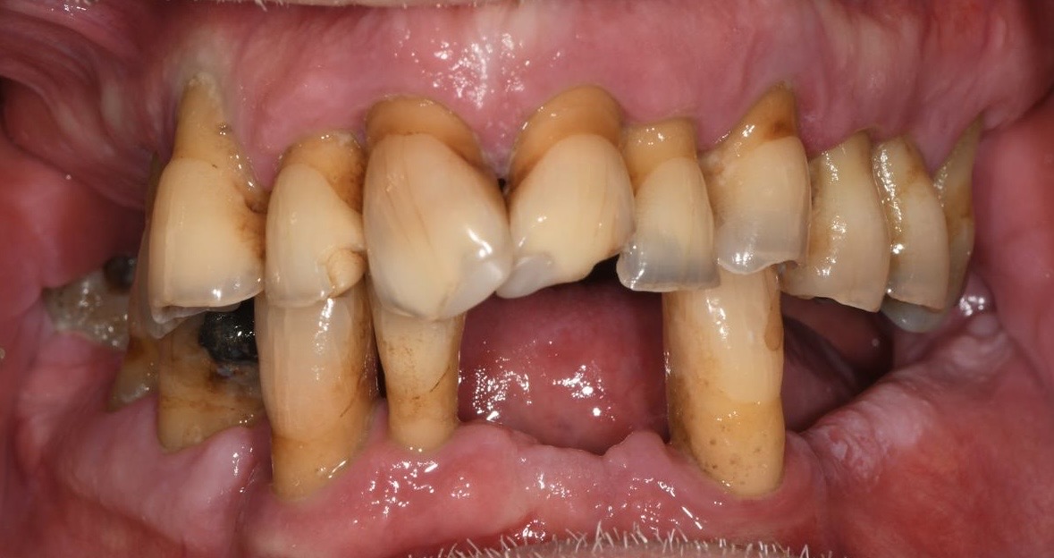Case before